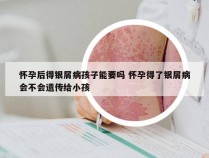 怀孕后得银屑病孩子能要吗 怀孕得了银屑病会不会遗传给小孩