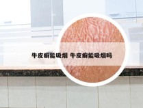 牛皮癣能吸烟 牛皮癣能吸烟吗