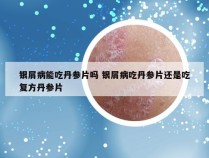 银屑病能吃丹参片吗 银屑病吃丹参片还是吃复方丹参片