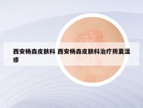 西安杨森皮肤科 西安杨森皮肤科治疗阴囊湿疹