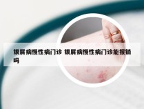银屑病慢性病门诊 银屑病慢性病门诊能报销吗