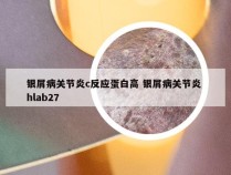 银屑病关节炎c反应蛋白高 银屑病关节炎 hlab27