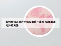如何用枯凡冰片m信石治疗牛皮癣 枯凡加冰片外用方法