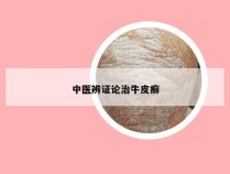 中医辨证论治牛皮癣