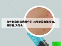 父母都没银屑病我咋的 父母都没有银屑病,我却有,为什么