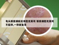 龟头银屑病蜕皮用他克莫司 银屑病他克莫司不能停,一停就复发