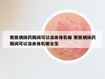 银屑病抹药期间可以涂身体乳嘛 银屑病抹药期间可以涂身体乳嘛女生