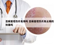 百癣夏塔热片有用吗 百癣夏塔热片有止痒的效果吗
