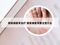 银屑病夏季治疗 银屑病夏天要注意什么