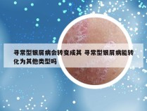 寻常型银屑病会转变成其 寻常型银屑病能转化为其他类型吗
