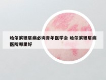 哈尔滨银屑病必询青年医学会 哈尔滨银屑病医院哪里好