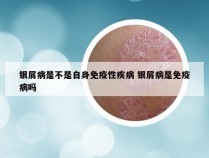银屑病是不是自身免疫性疾病 银屑病是免疫病吗
