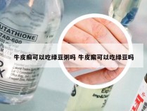 牛皮癣可以吃绿豆粥吗 牛皮廨可以吃绿豆吗