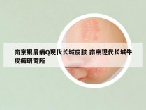 南京银屑病Q现代长城皮肤 南京现代长城牛皮癣研究所