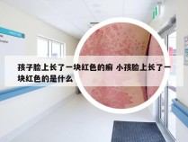 孩子脸上长了一块红色的癣 小孩脸上长了一块红色的是什么