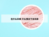 在什么长癣 什么情况下会长藓