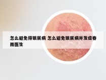 怎么避免得银屑病 怎么避免银屑病并发症春雨医生