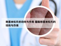 地塞米松片的功效与作用 醋酸地塞米松片的功效与作用