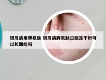 银屑病用脾氨肽 银屑病脾氨肽口服冻干粉可以长期吃吗