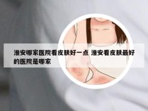 淮安哪家医院看皮肤好一点 淮安看皮肤最好的医院是哪家