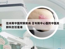 佳木斯中医院银屑病 佳木斯中心医院中医皮肤科主任是谁