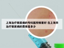 上海治疗银屑病的专科医院哪里好 在上海市治疗银屑病的费用是多少