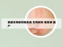 泰国生物制剂银屑病 生物制剂 银屑病 国产