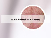 小鸡上长牛皮癣 小鸡皮癣图片