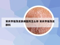 安庆李福发皮肤病医院怎么样 安庆李福发皮肤科