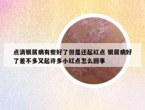 点滴银屑病有些好了但是还起红点 银屑病好了差不多又起许多小红点怎么回事