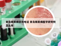 青岛银屑病咨询电话 青岛银屑病医学研究院怎么样