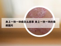 身上一块一块癣怎么回事 身上一块一块的像癣图片