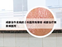 成都治牛皮癣的專科医院有那些 成都治疗银屑病医院