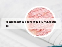 耳道银屑病达力士搽剂 达力士治疗头部银屑病