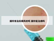 国珍有治白癜风的吗 国珍能治病吗