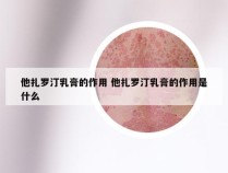 他扎罗汀乳膏的作用 他扎罗汀乳膏的作用是什么