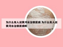 为什么有人说黄河水治银屑病 为什么有人说黄河水治银屑病呢