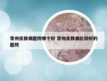 常州皮肤病医院哪个好 常州皮肤病比较好的医院