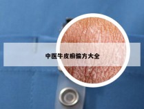 中医牛皮癣偏方大全