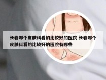 长春哪个皮肤科看的比较好的医院 长春哪个皮肤科看的比较好的医院有哪些
