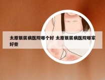 太原银屑病医院哪个好 太原银屑病医院哪家好些