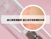 通辽银屑病医院 通辽治疗皮肤病的诊所