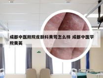 成都中医附院皮肤科黄莺怎么样 成都中医学院黄英