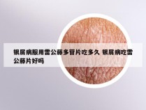 银屑病服用雷公藤多苷片吃多久 银屑病吃雷公藤片好吗