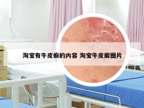 淘宝有牛皮癣的内容 淘宝牛皮廨图片