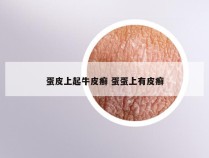 蛋皮上起牛皮癣 蛋蛋上有皮癣