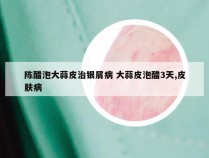 陈醋泡大蒜皮治银屑病 大蒜皮泡醋3天,皮肤病