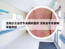 沈阳公立治疗牛皮癣好医院 沈阳治牛皮屑哪家医院好