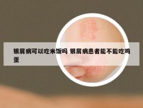 银屑病可以吃米饭吗 银屑病患者能不能吃鸡蛋