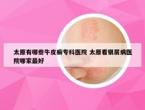 太原有哪些牛皮癣专科医院 太原看银屑病医院哪家最好